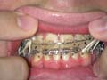 18mayteeth_640x480.JPG - 38902 Bytes