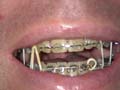 24mayteeth_640x480.JPG - 38907 Bytes