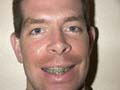 26mayteeth_640x480.JPG - 47093 Bytes