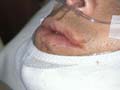 hospitalroomjawcloseup_640x480.JPG - 43579 Bytes